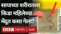 महिलेच्या मेंदूमध्ये आढळला 8 सेमी लांबीचा जिवंत किडा