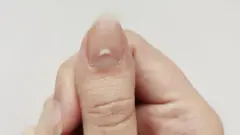 விரல் நகமும் ஆரோக்கியமும்