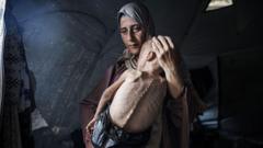 L'histoire de la photo d'Hedaya et de son bébé, l'une des images les plus choquantes de la famine à Gaza