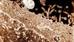 ஸ்க்ரப் டைபஸ் தொற்று, தமிழ்நாடு