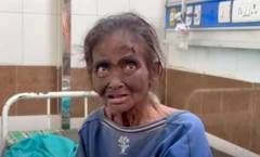મહિલા દર્દી