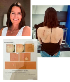 Annabel, seus exames e foto da cicatriz pós-operatória nas costas.
