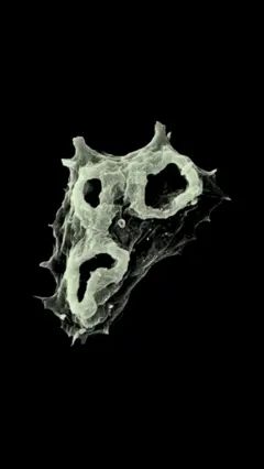 Ameba Naegleria fowleri