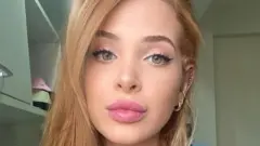 La dermatologue Amanda Parra, 29 ans, a eu la leptospirose en 2023