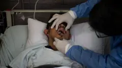 Seorang pasien yang terinfeksi cacar monyet di Lima, Peru, dirawat intensif pada Agustus 2022.