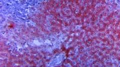 Cooma tiruu lubbuu baayyee galaafataa jiru akkamitti ofirraa ittisna?