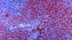 Tiruu coomni irratti mul'achuu jalqabe