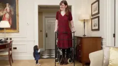 Rumeysa afise 215.16 cm, Jyoti Amge nawe 62.8 cm.