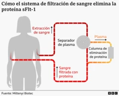 gráfico del sistema de filtración de sangre