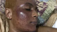 Nice alipoharibika ngozi yake 