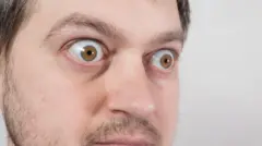 Un homme avec les yeux globuleux