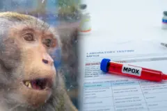 كيف تحمي نفسك من مرض جدري القردة؟