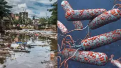 Aworan omi ti ko dara àti cholera 