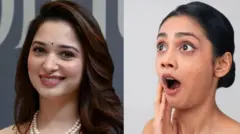 இதில் சில வீட்டு வைத்தியங்களும் அடங்கும். ஆனால், தவறான முறையைப் பின்பற்றினால் இப்பிரச்னை இன்னும் மோசமடையக்கூடும். 