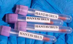 Hantavirus