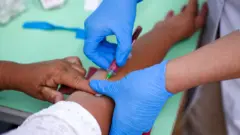 "Баягыдай демдүү жүрө албай калдым", уйкум кадимкидей эле бузулду" деген сыяктуу түрдүү пикрилерди айтып келишет