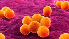 स्ट्याफाइलोकोकस अरिअस ब्याक्टेरिया