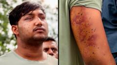 సీజేపీ నిరసనకారులకు తగిలినవి పెల్లెట్ గన్ గాయాలే : బీబీసీతో నిపుణులు