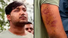దిల్లీ జంతర్ మంతర్, కాక్రోచ్ పార్టీ నిరసన, పెల్లెట్ కాల్పులు, గాయాలు