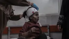 
یک کودک زخمی فلسطینی که به سرش بانداژه بسته شده و در شفاخانه شفا در شهر غزه بعد از حمله ۱۹ نوامبر ۲۰۲۵ اسرائیل منتقل شده است 