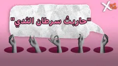 صورة من حلقة بي بي سي اكسترا عن سرطان الثدي