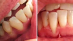 Close up of teeth