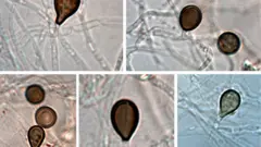 betmenova gamsia, mikroskopski prikaz mikroorganizama - gljiva