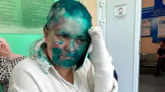 خانم میلاشینا می‌گوید ضاربان تلاش کردند انگشتانش را بشکنند و از او خواستند رمز تلفن همراهش را به آن‌ها بدهد،