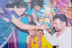 கைமாற்று அறுவை சிகிச்சை, நவீன மருத்துவ முறை, காதல்