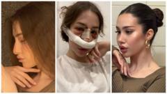 «Психотерапия со скальпелем». Почему молодые девушки в России все чаще делают пластику