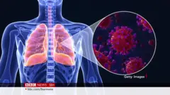 HMPV အသက်ရှူလမ်းကြောင်း ဆိုင်ရာ ဗိုင်းရပ်စ် ဆိုတာ ဘယ်လိုမျိုးလဲ