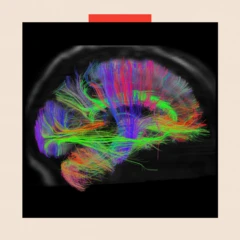 Brain scan images.