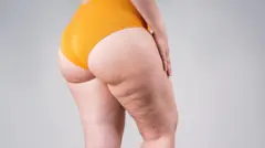 Žena u donjem vešu sa celulitom na nogama