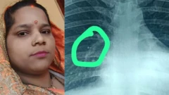நுரையீரலில் சிக்கிக்கொண்ட மூக்குத்தி திருகு