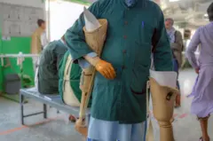 یک فرد دارای معلولیت که دست مصنوعی دارد یک پای مصنوعی را زیر بازوی راست خود گرفته است. یک پای مصنوعی دیگر هم در دست چپش است.