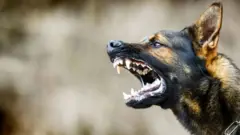 தெருநாய் பிரச்னை, நாய்க்கடி, நாய் மனித மோதல்