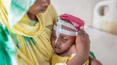 Haadha daa'ima beelaan miidhamte qabattee jirtu