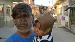 ஓநாய்-மனித நோயால் பாதிக்கப்பட்ட 17 வயது மாணவர்