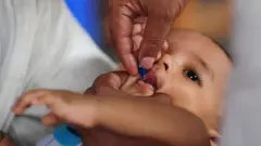শিশুকে ভিটামিন এ ক্যাপসুল খাওয়ানো হচ্ছে
