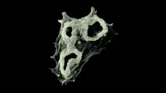 Imagem ampliada da 'ameba comedora de cérebros', Naegleria fowleri, sobre fundo escuro