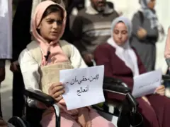 طفلة فقدت أطرافها خلال حرب غزة