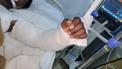 Ukuboko kw'umusore kwacitse kugasubizwaho n'abaganga b'inzobere