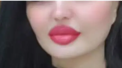 مژگان، ۳۷ ساله در کابل که سه عمل زیبایی صورت انجام داده.      
