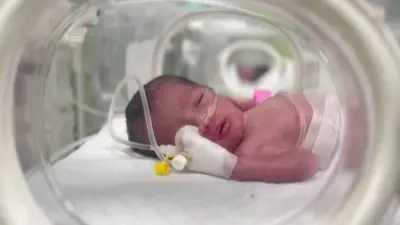beba spasena iz utrobe majke u inkubatoru
