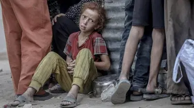 Niña con grave desnutrición sentada en el piso