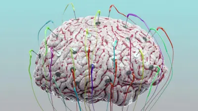A generated image of a brain suspended against a light background with colourful electrodes attached to it.