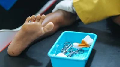 விருத்தசேதன அறுவை சிகிச்சை