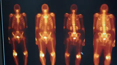 Imagens do corpo usando tecnécio.