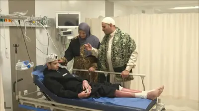 "إبراهيم" صاحب حالة زراعة الجلد البشري المستورد من الخارج 