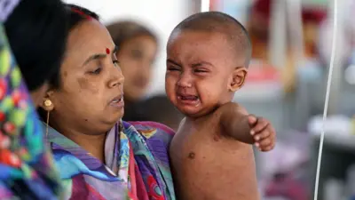 A baby spotted with measles marks cries, sitting on the hip of a women who looks at them with concern.